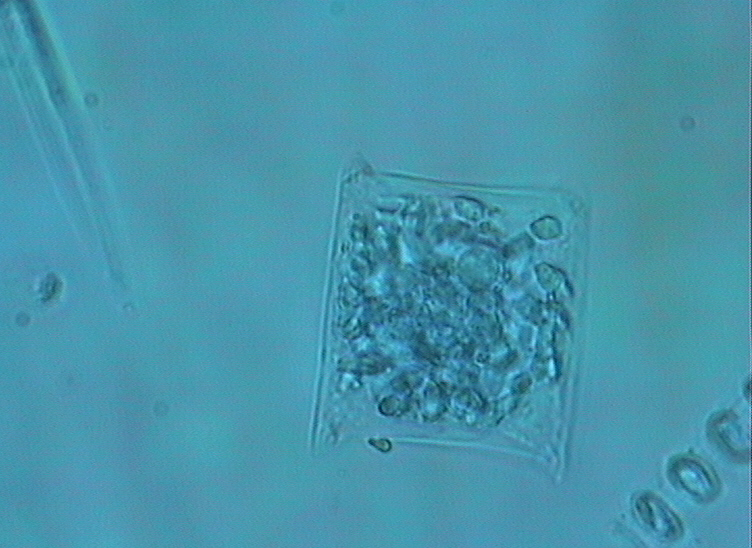 Dictyocha speculum